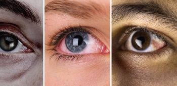 Opthalmology