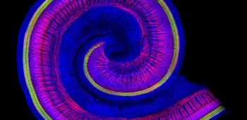 Vestibular