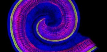 Vestibular